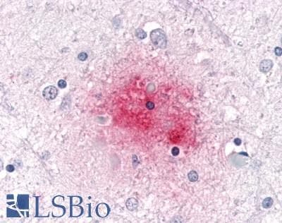 PathPlus™ SGK3 Antibody (N-Terminus)