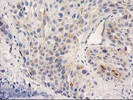 PLEKHA3 Antibody (clone OTI5D11, Carrier-free)