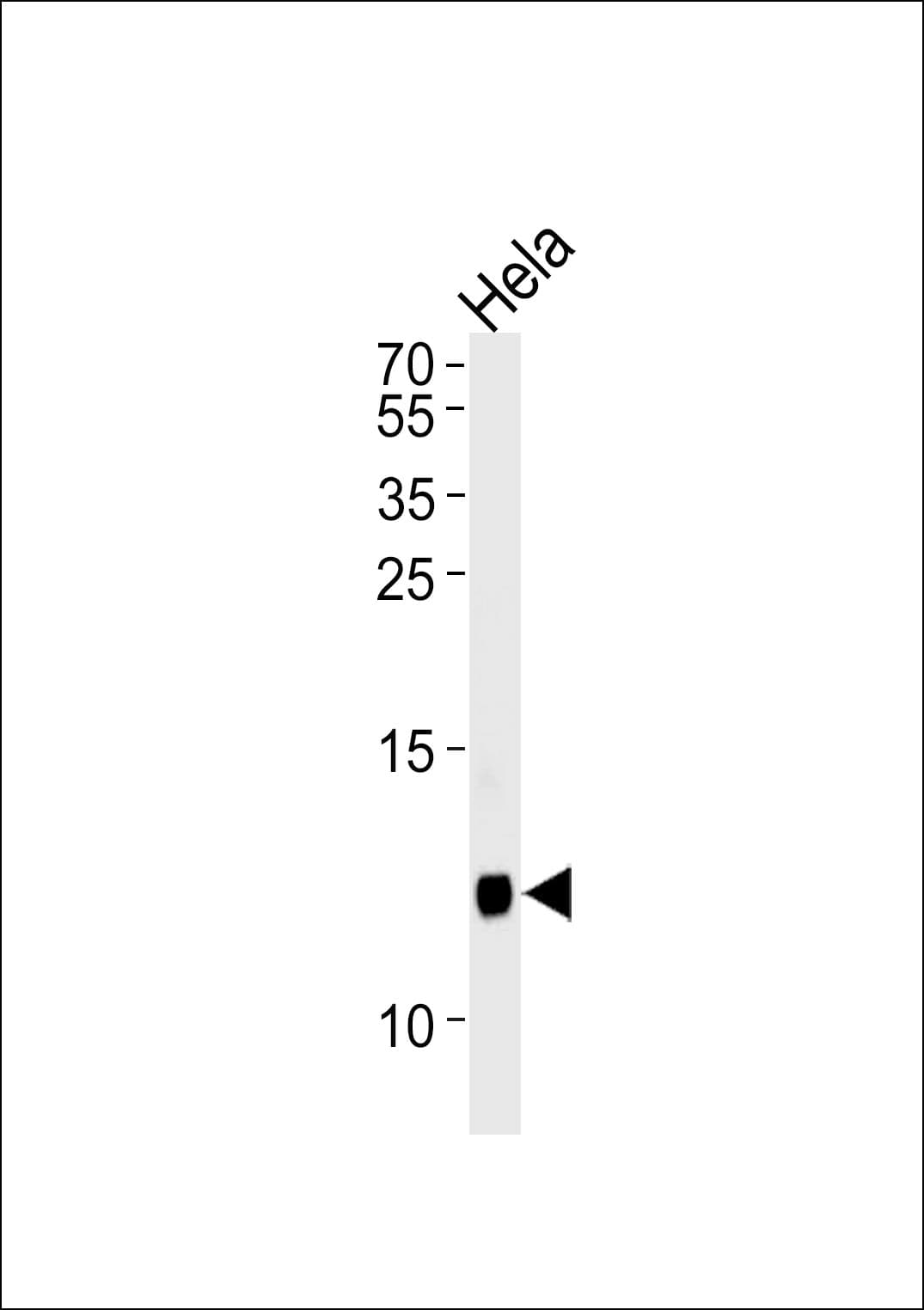 B2M / Beta 2 Microglobulin Antibody (aa71-98)