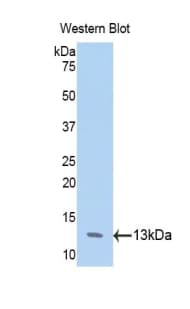 ANXA4 / Annexin IV Antibody (aa165-260)