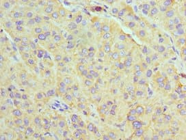 Polyclonal Rabbit anti-Human U2AF1 Antibody (aa1-240, IHC)