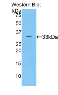 CP / Ceruloplasmin Antibody (aa789-1065)