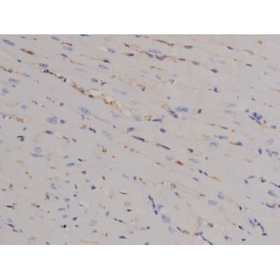 STAT6 Antibody (phospho-Tyr641)