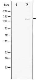 Polyclonal Rabbit anti-Human PDGFRA / PDGFR Alpha Antibody (WB)