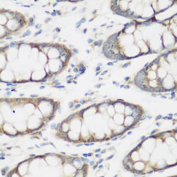 SHBG Antibody