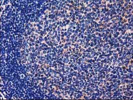 GALE / UDP-Glucose 4-Epimerase Antibody (clone OTI1C4)