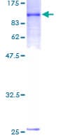 Human IL21 Receptor Protein (Recombinant GST)