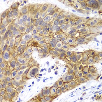 CLDN1 / Claudin 1 Antibody