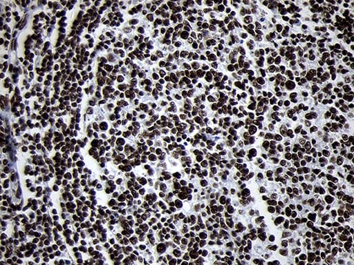 SMC1A / SMC1 Antibody (aa889-1016, clone OTI11E1)