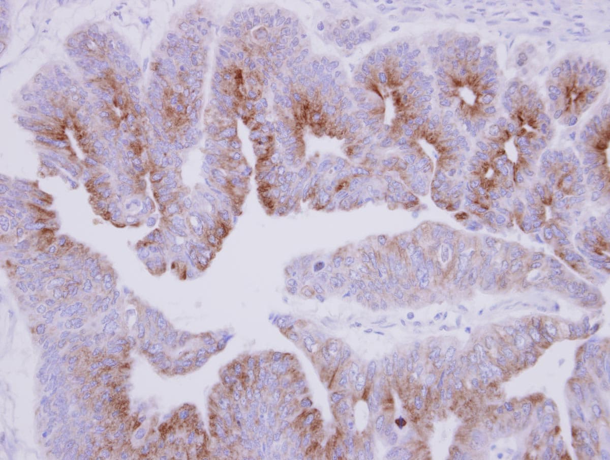 Polyclonal Rabbit anti-Human MAP7 Antibody (C-Terminus, IHC, WB)