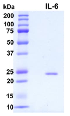 Human IL6 / Interleukin 6 Protein (Recombinant 6His, N-terminus)