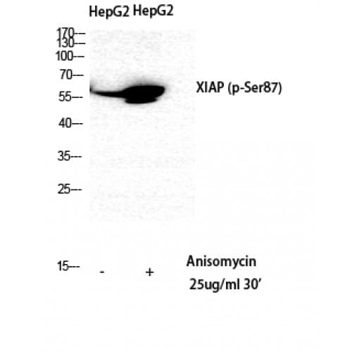 Polyclonal Rabbit anti-Human XIAP Antibody (30-110 aa, IHC, WB)