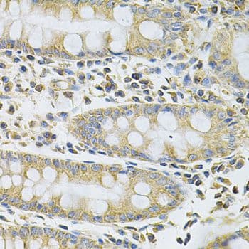 SERPINA6 / CBG Antibody