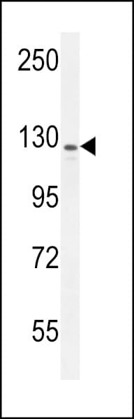 Polyclonal Rabbit anti-Human IBTK Antibody (aa586-613, IHC, WB)