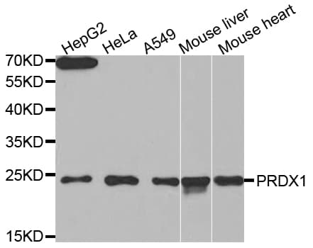 Polyclonal Rabbit anti-Human PRDX1 / Peroxiredoxin 1 Antibody (IF, WB)
