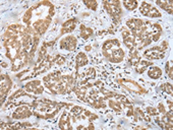 MOB4 / PHOCN Antibody