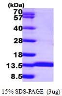 Human ACYP1 Protein (Recombinant His)
