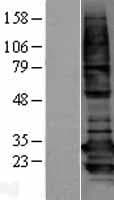 Human BCAP31 / BAP31 Protein (Over-Expression Lysate Myc-DDK (Flag))
