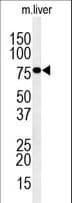 Polyclonal Rabbit anti-Human FLJ20309 Antibody (aa63-91, IHC, WB)
