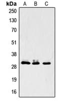 LASP1 Antibody (Internal)