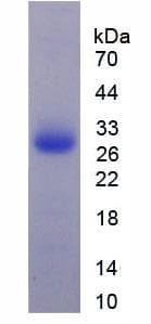 Human Complement C1QA Protein (Recombinant His, N-Terminal)