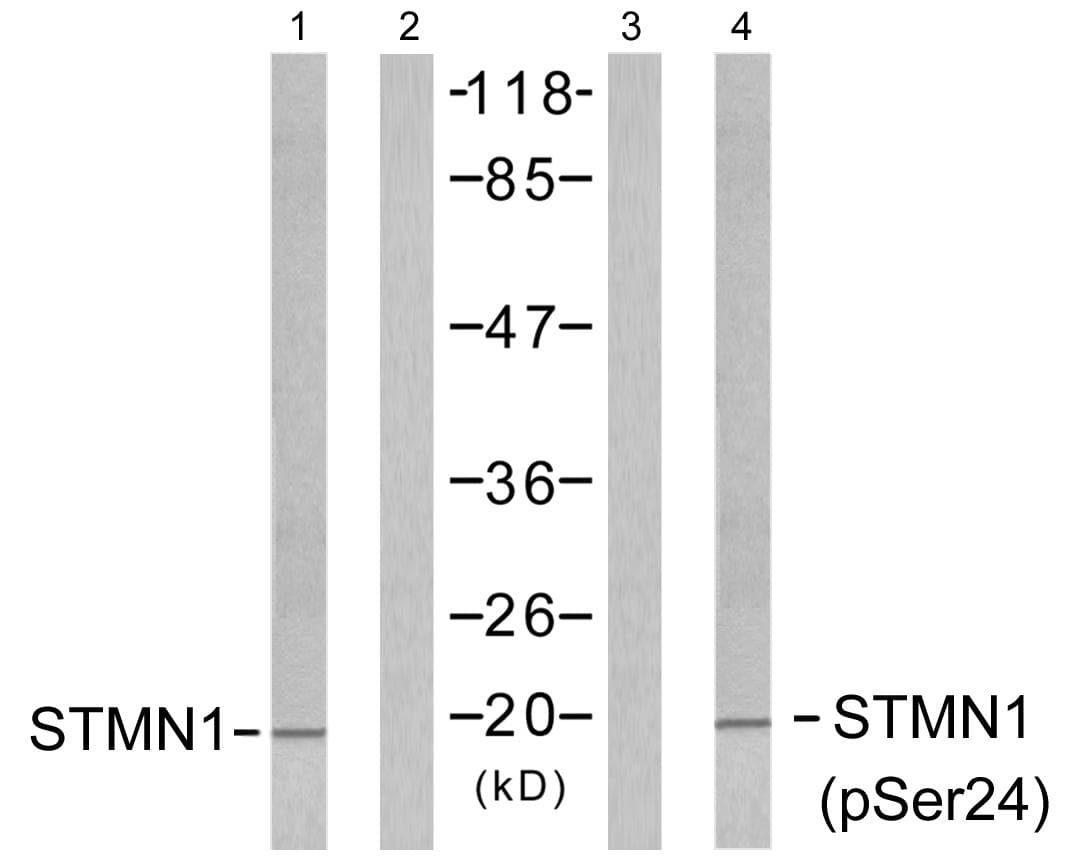 Polyclonal Rabbit anti-Human STMN1 / Stathmin / LAG Antibody (phospho-Ser24, IHC, WB)