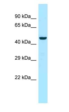 MYOT / Myotilin Antibody (aa384-433)