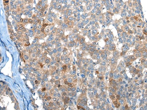 Polyclonal Rabbit anti-Human BHMT2 Antibody (IHC, WB)