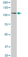 CCK4 / PTK7 Antibody (clone 4C6)
