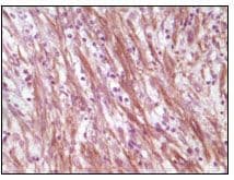 DES / Desmin Antibody (clone 10H7D2)