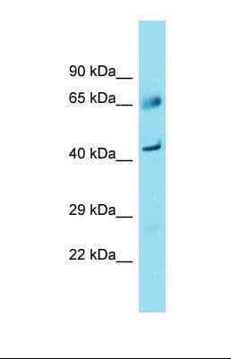 Polyclonal Rabbit anti-Human FAM83A Antibody (C-Terminus, WB)