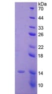 Human AMH / Anti-Mullerian Hormone Protein (Recombinant His, N-Terminal)
