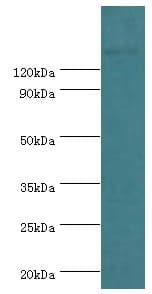 Polyclonal Rabbit anti-Human SMARCC2 Antibody (aa300-650, IHC, WB)