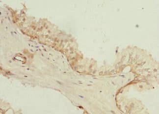 Polyclonal Rabbit anti-Human PHLDA2 / TSSC3 Antibody (IHC)