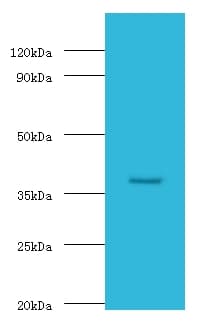 GALT Antibody