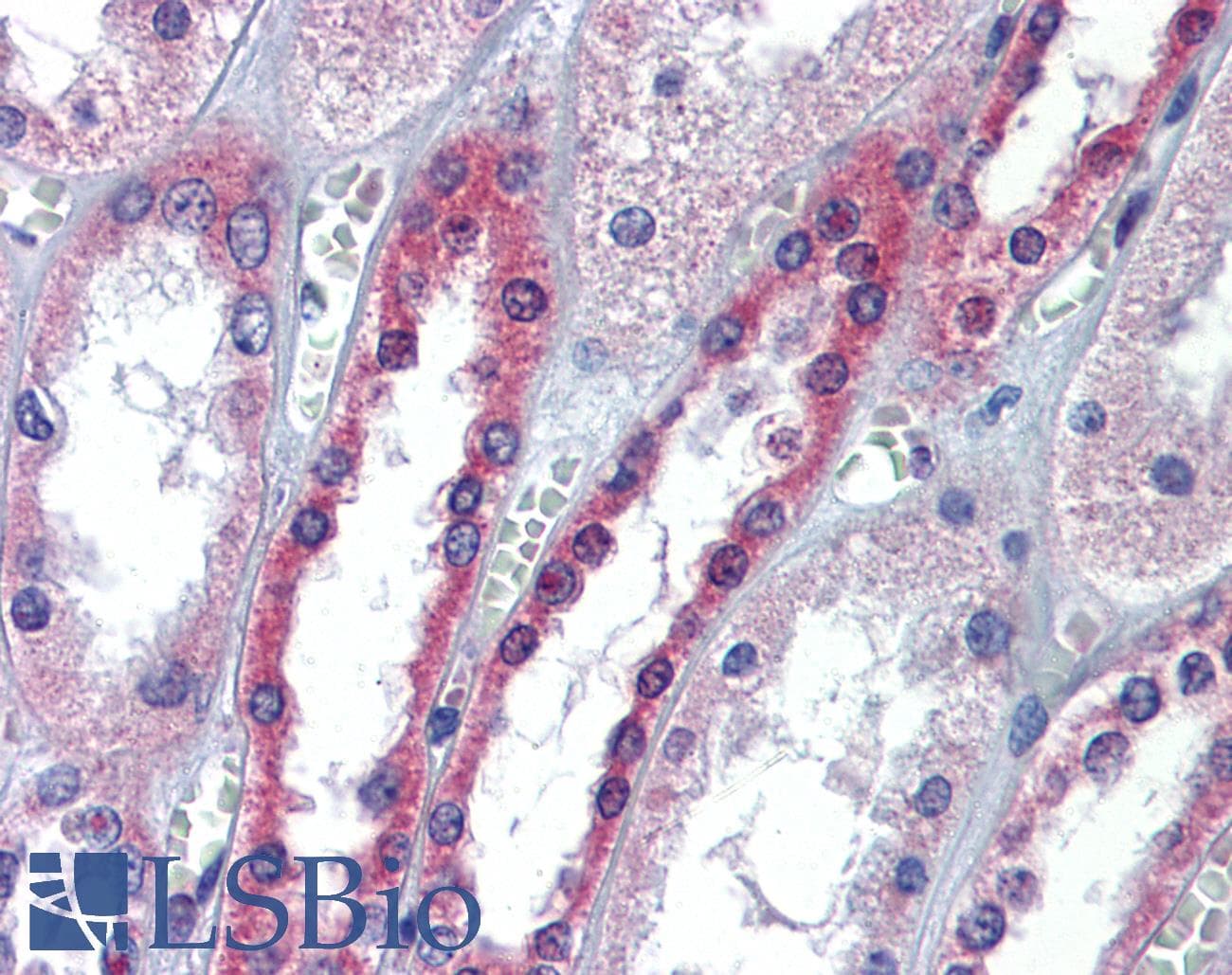 PathPlus™ Polyclonal Rabbit anti-Human OCLN / Occludin Antibody (aa35-84, IHC, WB)