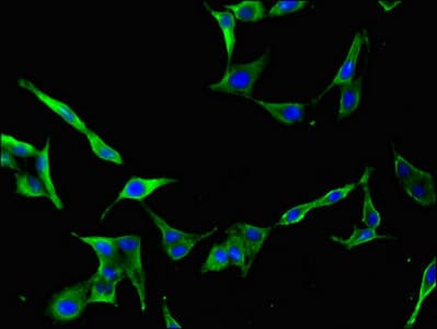 CDC25B Antibody