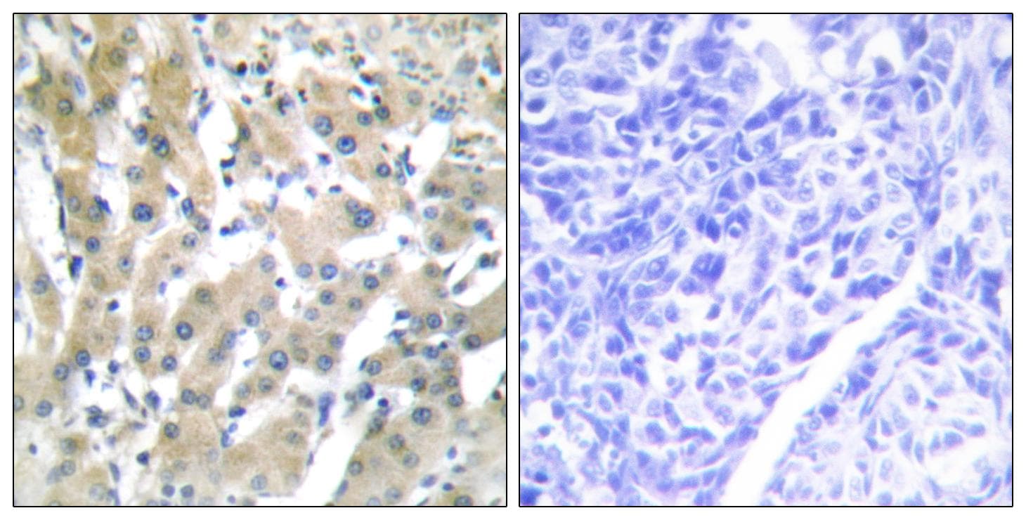 F2 / Prothrombin / Thrombin Antibody