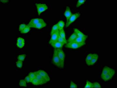 HAL / Histidine Ammonium Lyase Antibody