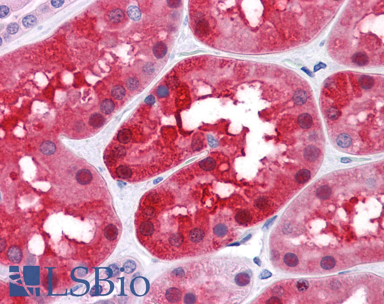 IHC-plus™ TTC1 Antibody (clone 4E3)