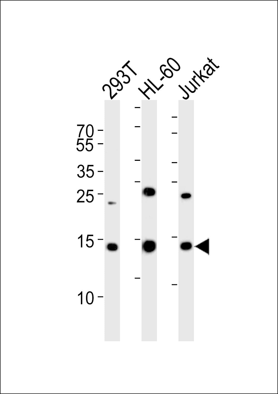 SUMO2 Antibody (aa63-93)
