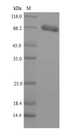 Human PNPLA2 / ATGL Protein (Recombinant 6His-SUMO, N-terminus)
