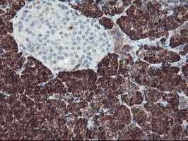 Monoclonal Mouse anti-Human CPA1 / Carboxypeptidase A Antibody (clone OTI2E3, IHC, IF, WB)