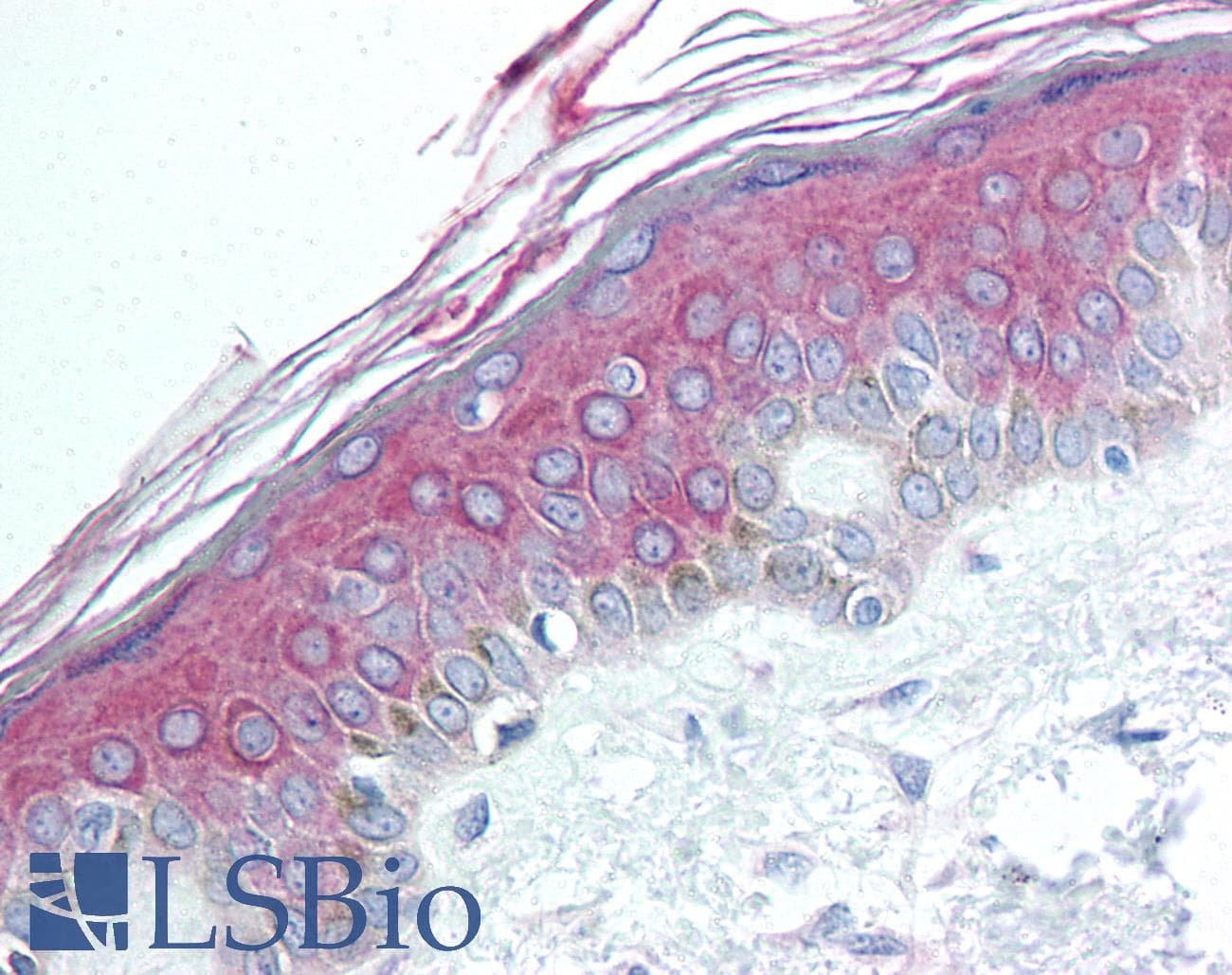IHC-plus™ HDAC4 Antibody (N-Terminus)