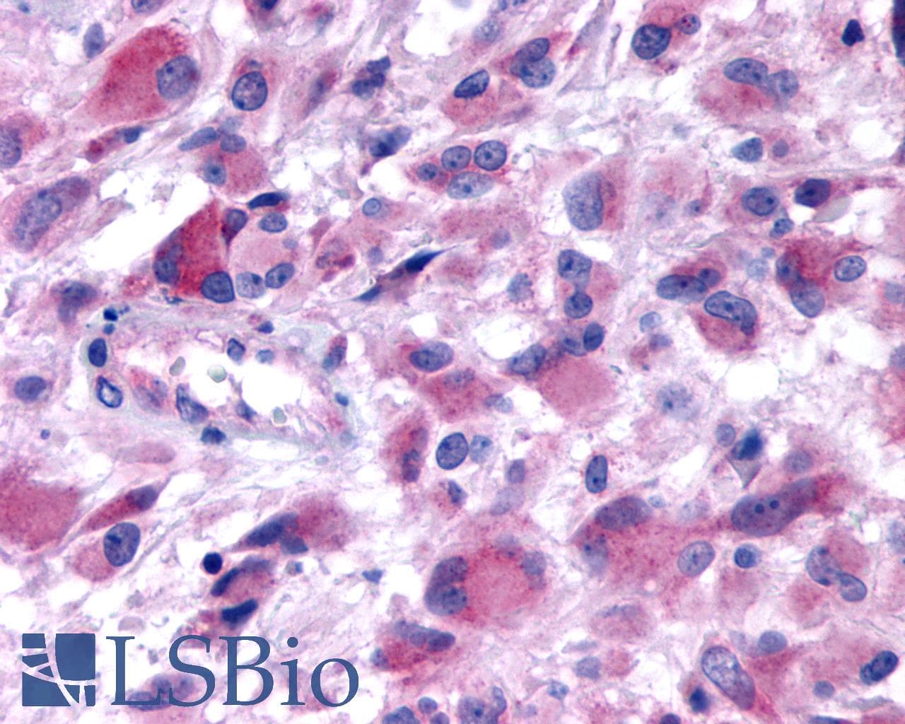PathPlus™ HTR2B / 5-HT2B Receptor Antibody (N-Terminus)