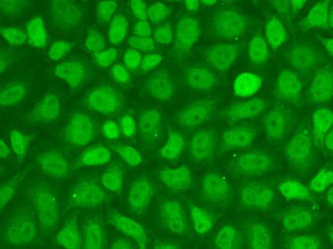 CXXC1 / CGBP Antibody