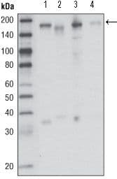 Monoclonal Mouse anti-Human MST1R / RON Antibody (clone 1B5A9, Amino Acid: 210-320, WB)