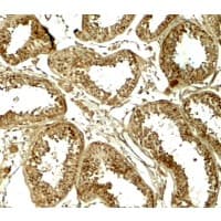 HDAC6 Antibody