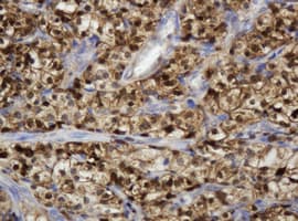 TP / Thymidine Phosphorylase Antibody (clone OTI1H7)
