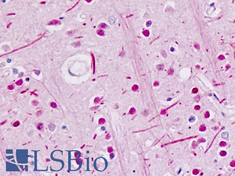 IHC-plus™ Polyclonal Rabbit anti-Human ABL Antibody (Tyr251, IHC, WB)